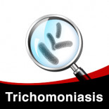 Treatment scheme against Trichomoniasis (Canker) in birds